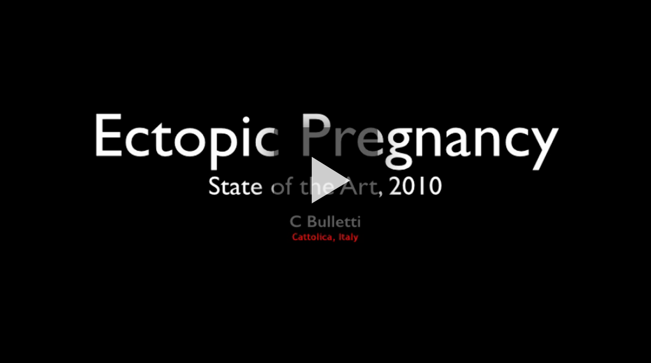 Ectopic Pregnancy