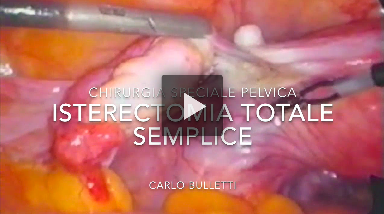 Isterectomia totale semplice